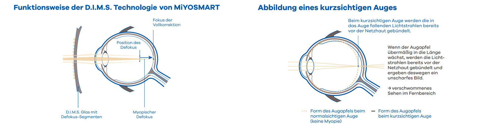 hoya-miyosmart-info